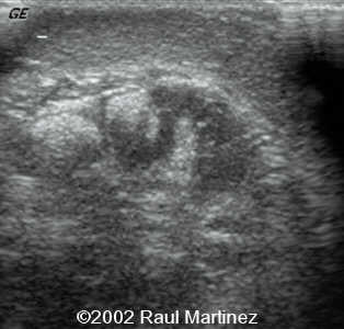 case0066-14