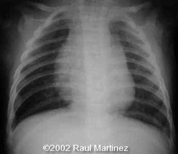 case0066-15