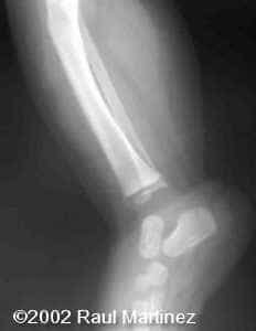case0066-16