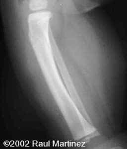 case0066-17