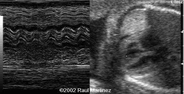 case0066-5