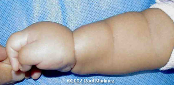 case0066-8