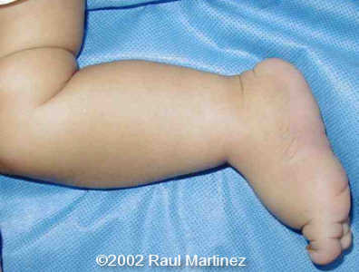 case0066-9