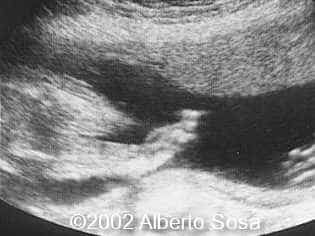 case0067-2