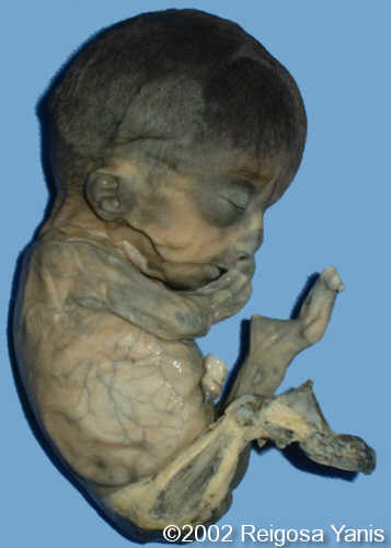 case0067-4