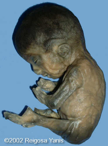 case0067-5