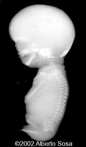 case0067-6