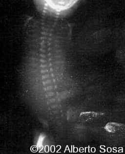 case0067-7