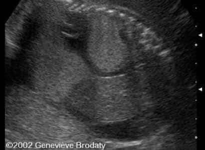 case0068-11