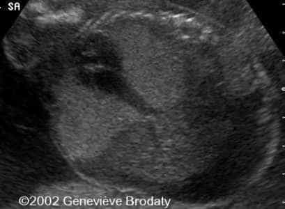 case0068-12