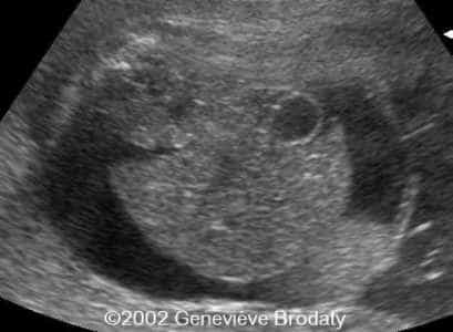 case0068-13