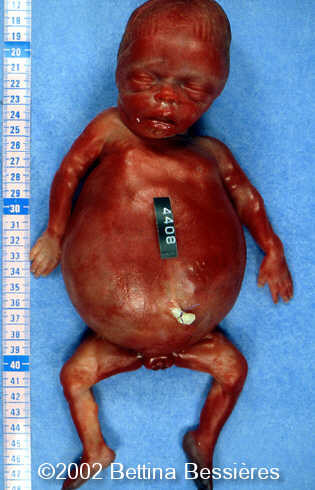 case0068-14