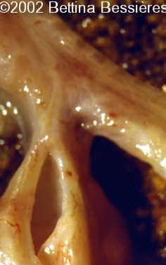 case0068-15