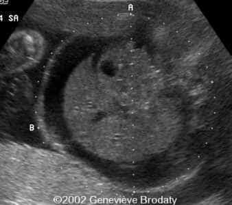 case0068-2