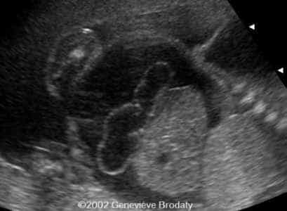 case0068-4