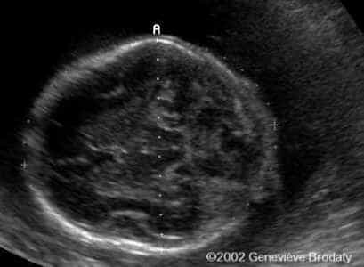 case0068-5