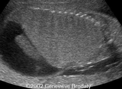 case0068-6