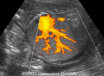 case0068-7