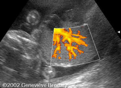 case0068-9