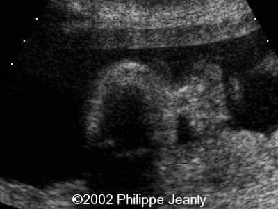 case0069-10