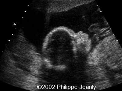 case0069-13