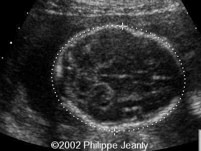 case0069-3