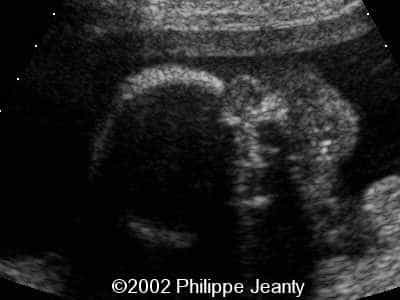 case0069-4