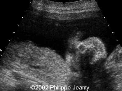 case0069-7