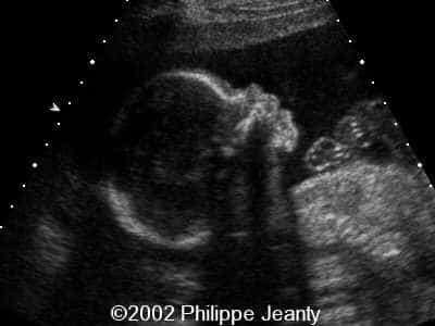 case0069-9