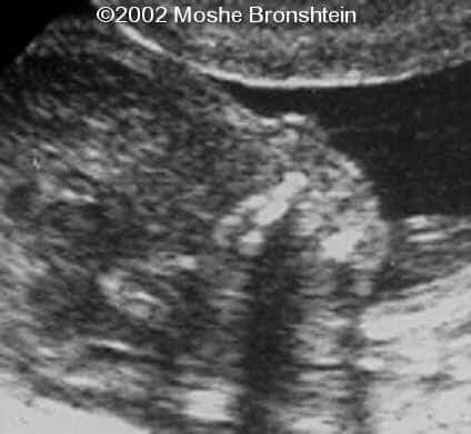 case0071-1