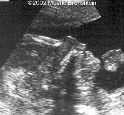 case0071-2