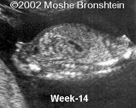 case0071-5