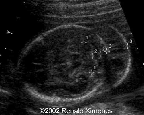 case0072-1