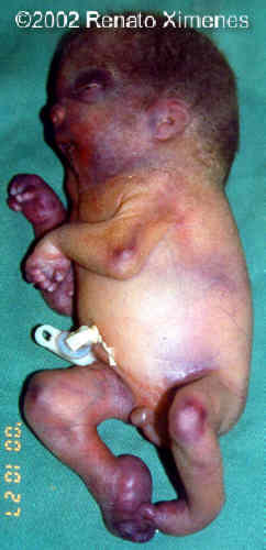 case0072-11