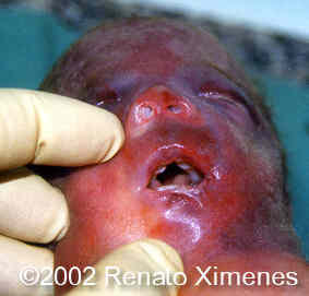 case0072-14