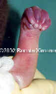 case0072-15