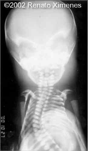 case0072-17
