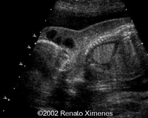 case0072-3