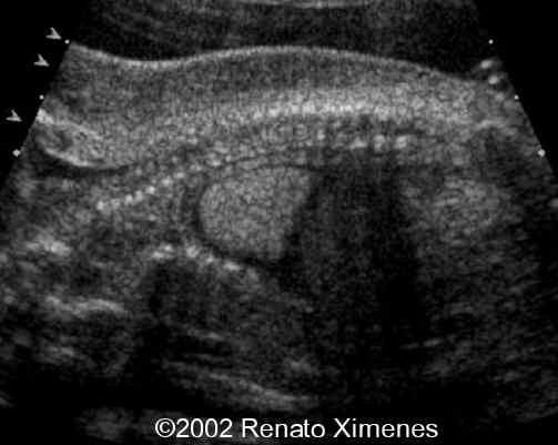 case0072-4