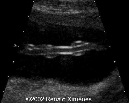 case0072-6