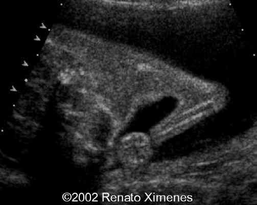case0072-7