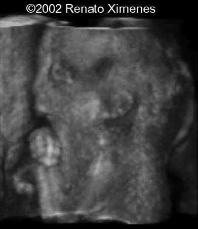 case0072-9