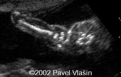 case0073-1