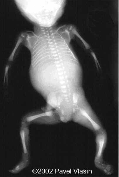 case0073-11