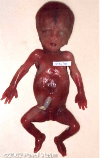 case0073-12