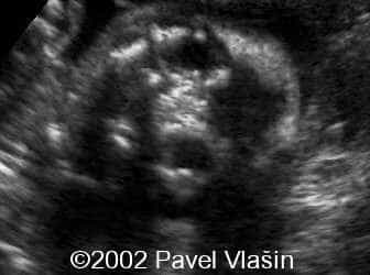 case0073-6