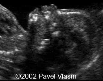 case0073-7