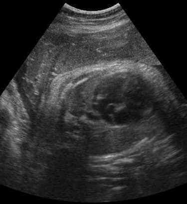 case0074-1
