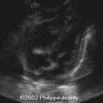 case0074-10