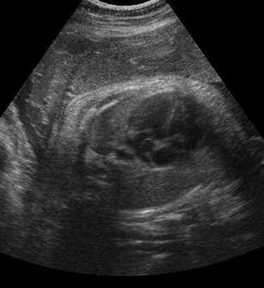 case0074-2